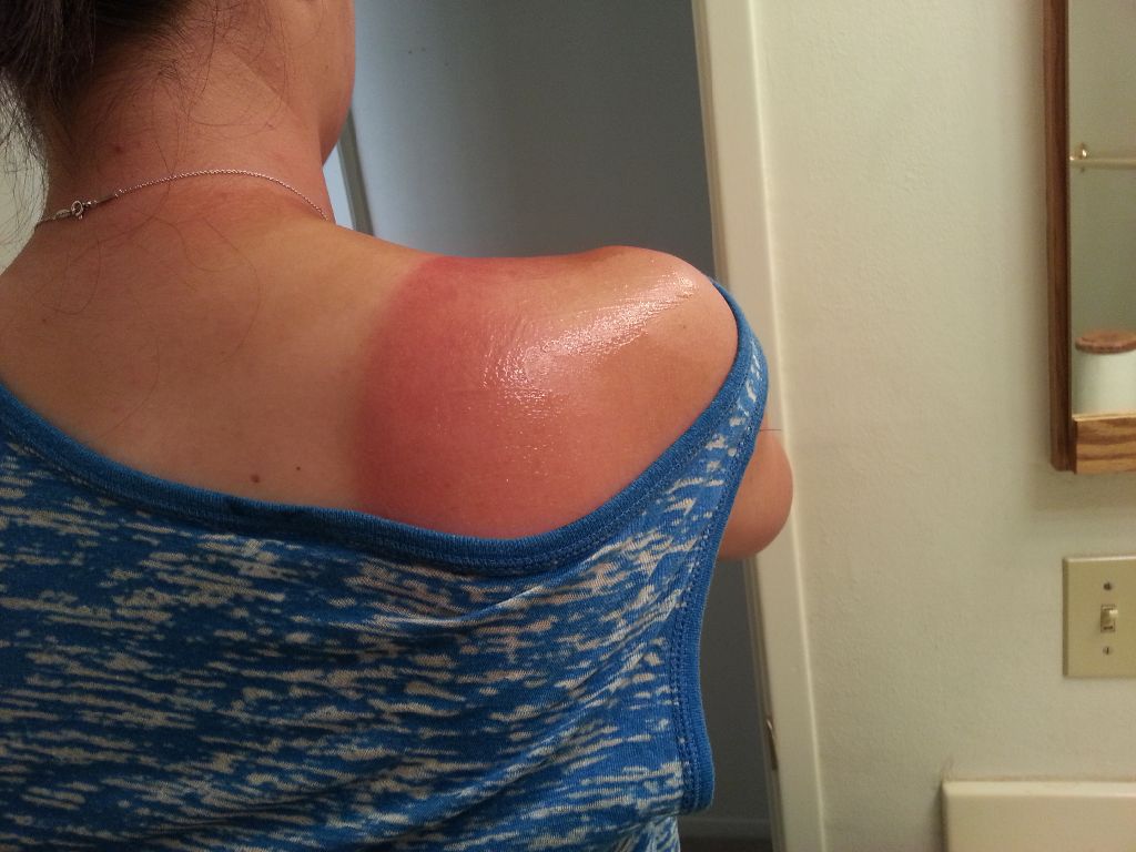 Give me some aloe